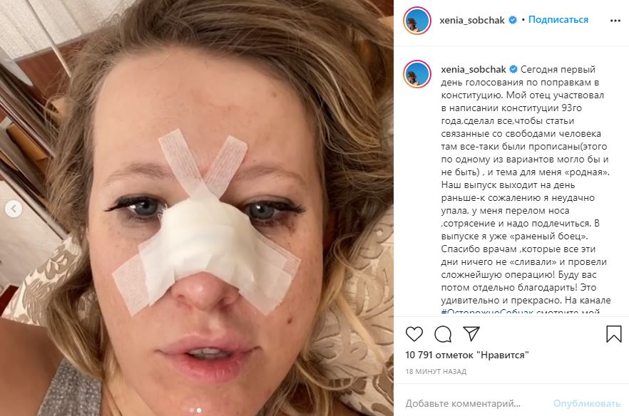 Ксения Собчак сломала нос — видео